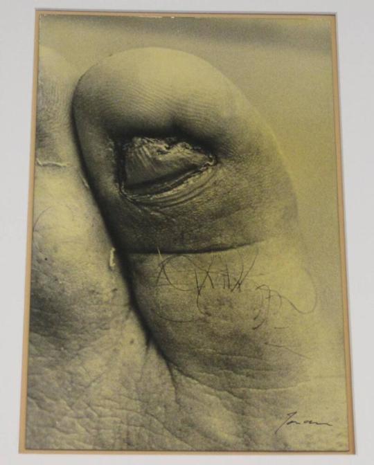 Untitled (toe with wrinkled nail, DC)