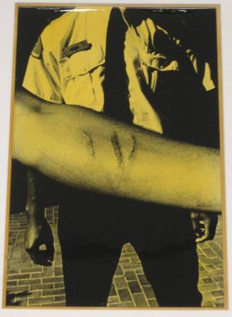 Untitled (man with scratches on arm, guard background, DC)