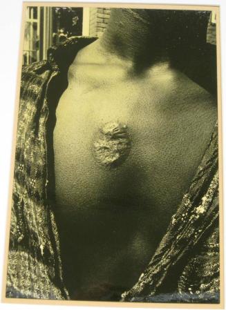Untitled (young man with scarred chest, DC)