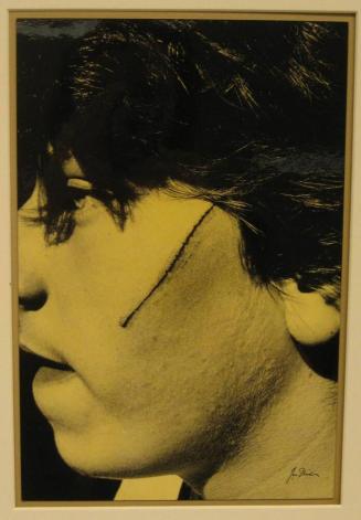 Untitled (boy with straight-line scar, DC)