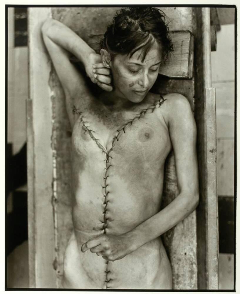 autopsy　woman nude Woman Who Died in Her Sleep | All Works | The MFAH Collections