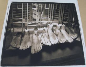 Feet waiting for legs - 1993, Kien Khlaeng Clinic (VVAF), Cambodia