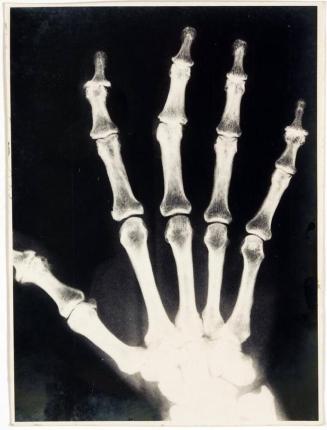 Thought you might need an X-ray hand around the place