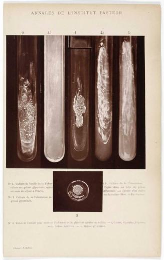 Test Tubes with Tuberculosis Germs in Glycerin Gel