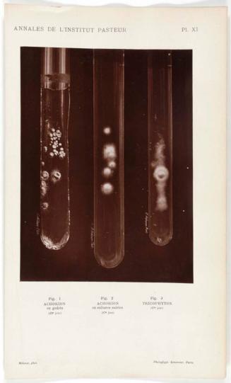 Test Tubes with Fungus Samples