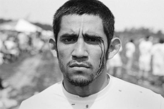 Jeremy Avelar on His Way to the Medical Tent, Quidditch World Cup VII – South Myrtle Beach, South Carolina