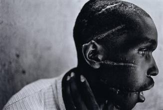 Survivor of Hutu death camp, Rwanda