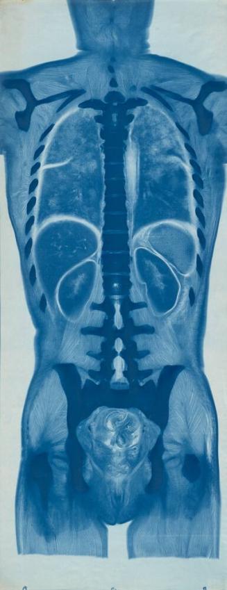 [Cross-section of a Male Torso]