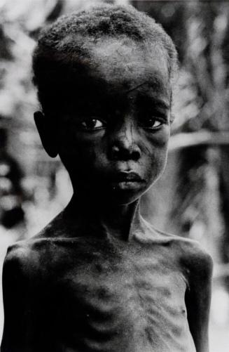 Close up of nine-year-old Biafran boy waiting in a food queue