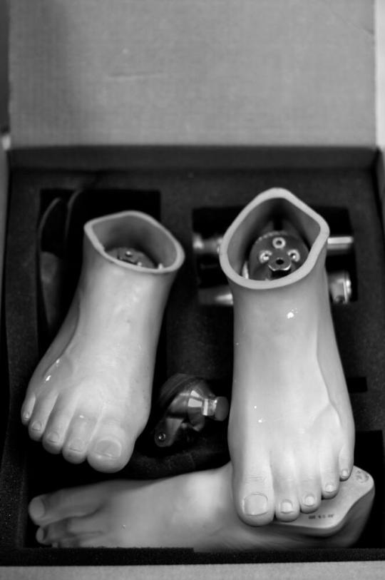 Prosthetic Feet