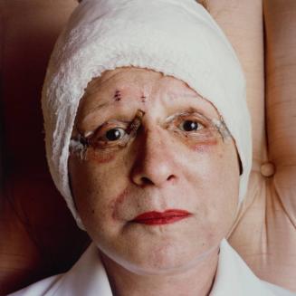 Mother recuperating from her facelift, Houston