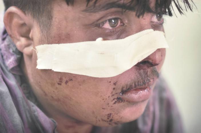 Waiting for stitches: Ali Amouck Hospital, Baghdad
