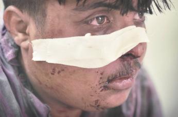 Waiting for stitches: Ali Amouck Hospital, Baghdad