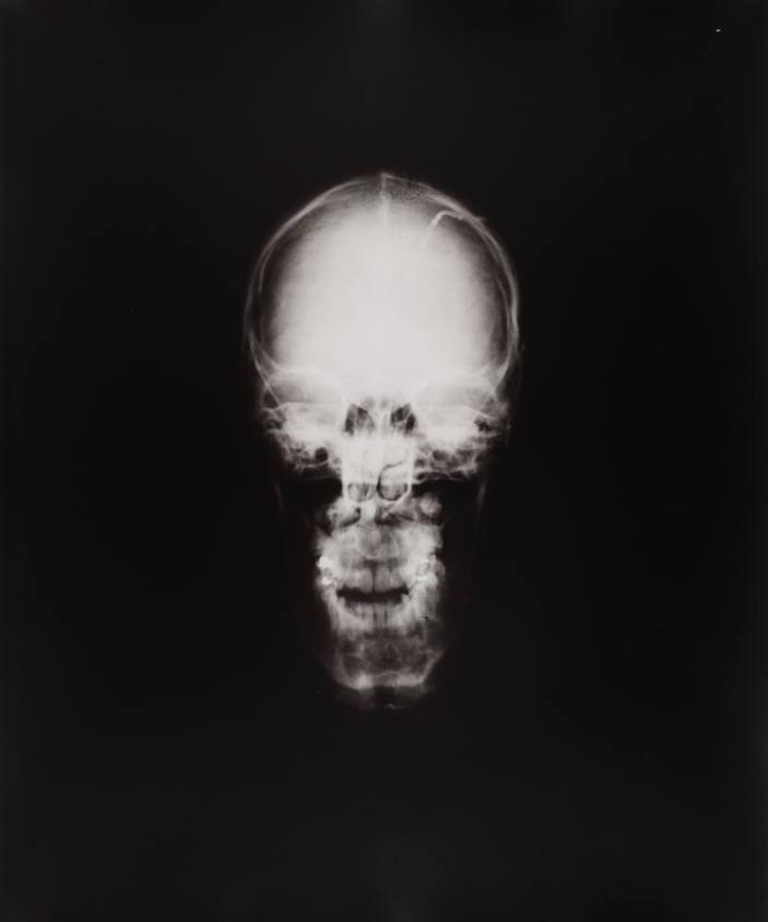 Light Memory #17