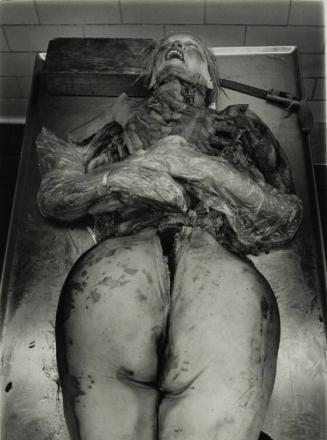 Cadaver, New York City